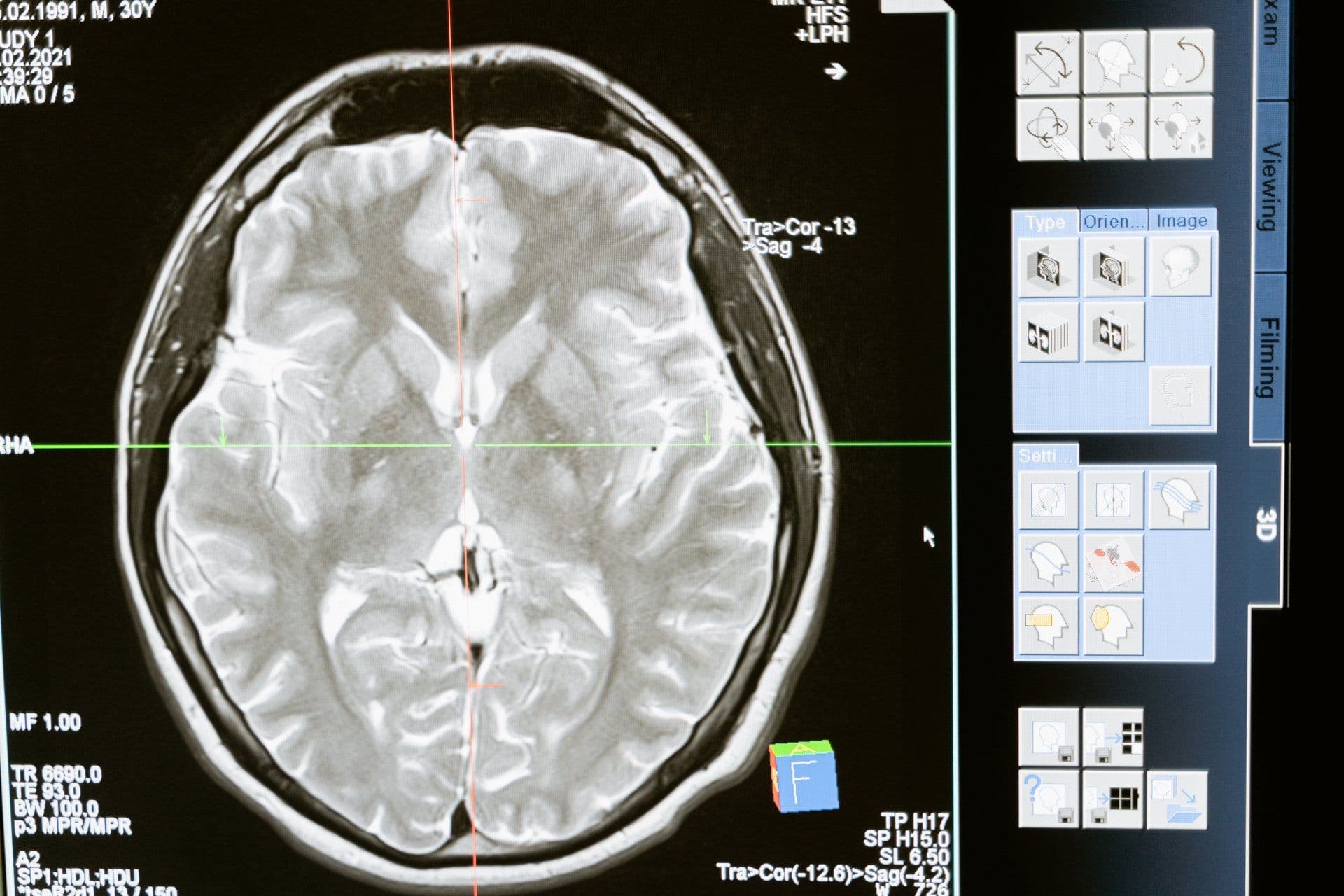 Cognitive Corner: Exploring Brain Health and Intellectual Growth